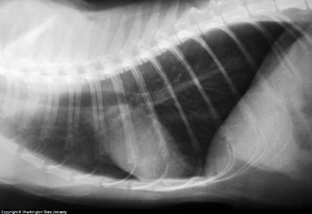 Corticosteroids anti inflammatory