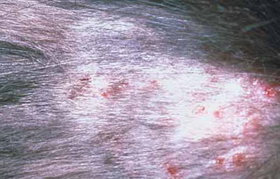 cat hair loss - example 1 - miliary dermatitis