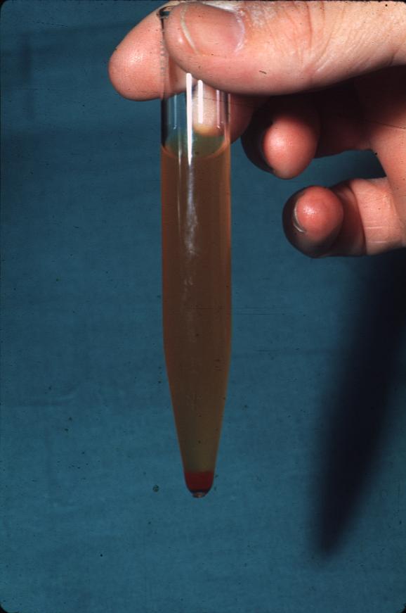 Picture blood in cat urine