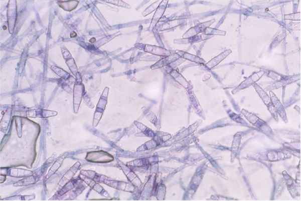 Ring Worm Cats Symptoms and Treatment