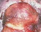 Picture of Cat Skin Tumor