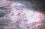 cat hair loss dermatitis